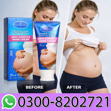 Anti Stretch Mark Cream Price In Pakistan