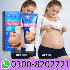 Anti Stretch Mark Cream Price In Pakistan